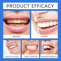 Propolis Oral Instant Spray, Clean Your Teeth To Protect The Gum Freshen Breath Oral Care Spray