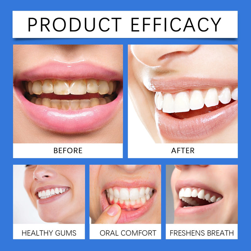 Propolis Oral Instant Spray, Clean Your Teeth To Protect The Gum Freshen Breath Oral Care Spray