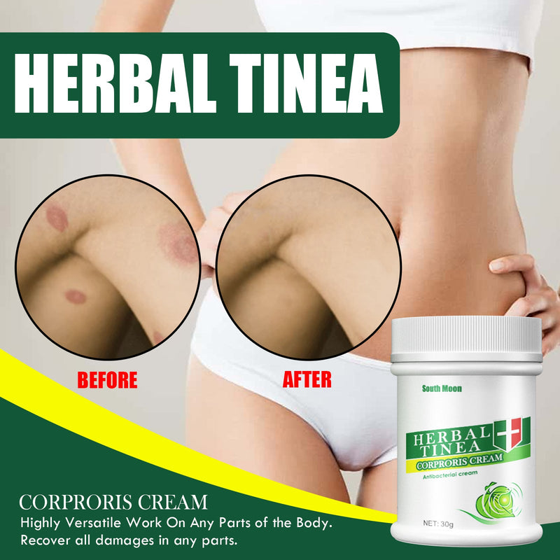 Herbal Tinea Corproris Cream, Mild Non-Irritating Ointment For Itch Relief External Ointment For The Body