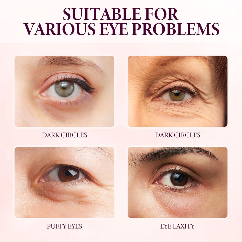 Mango Eye Cream Reduces Fine Lines Of Crow's Feet Bags And Gently Nourishes Elasticity And Tightens The Skin Around Eyes