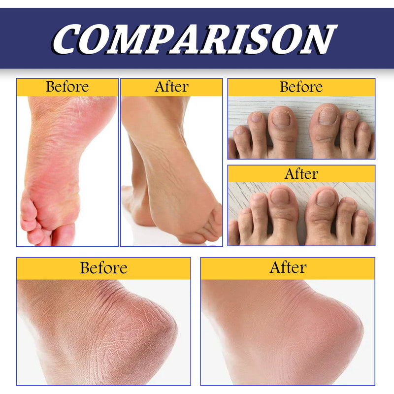 South Moon Urea Hand And Foot Cream, Anti-Crack Peeling Repair Skin Crack Dry Moisturizing Skin Soothes Skin