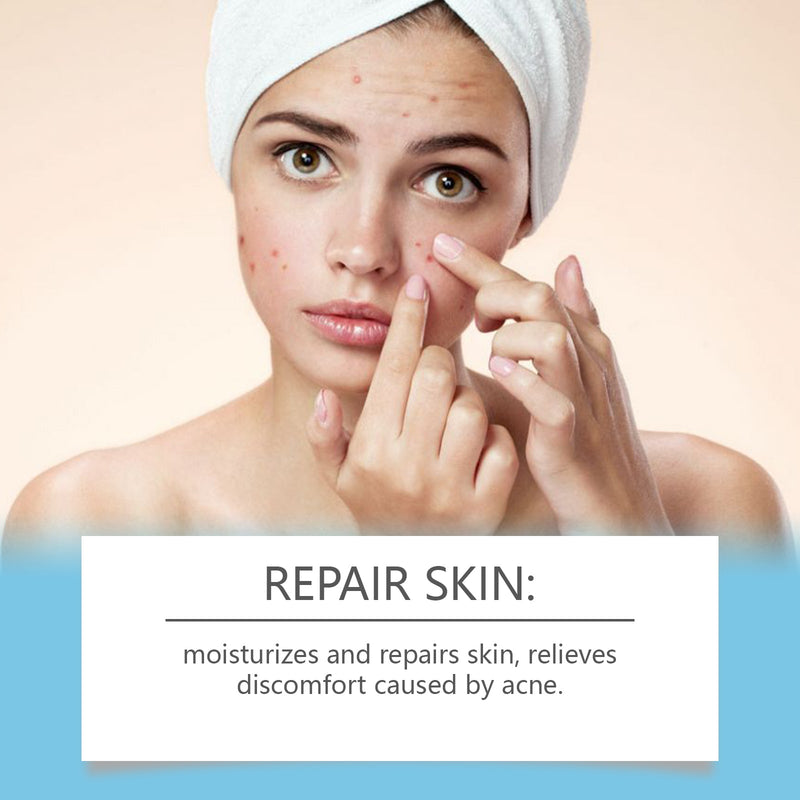 Acne Repair Cream Acne Mark Treatment Improve Acne Muscle Cleansing Cream For Closed Mouth Acne