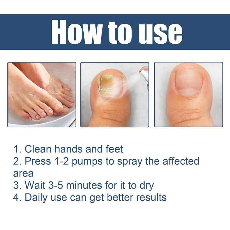 Nail Care Spray Gently Cleans Foot Nails Moisturizing And Brightening Nail Care Spray
