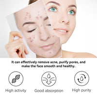 Herbal Acne Serum, Reduce Acne Pimples With A Comprehensive Moisturizing Moisturizer