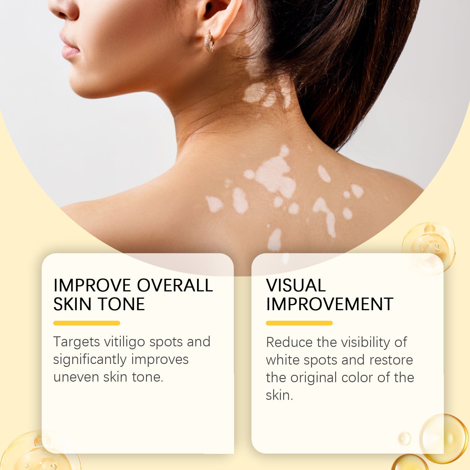 Bee Venom White Spot Care Cream Bee Venom Repair Skin Moisturizing Skin Care Topical Cream