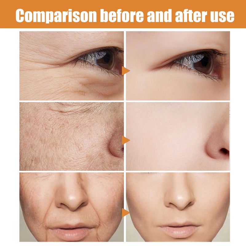 Vitamin C Collagen Facial Essence, Hydrating And Moisturizing Smooth Day And Night Hydrating Facial Essence