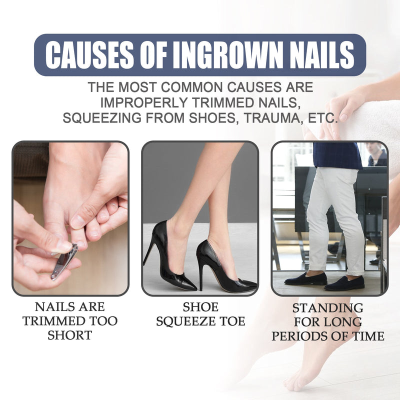 Nail Repair Oil Hand And Foot Repair Inlaid Toenails Soft Nails Daily Moisturizing Nail Care