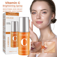 Vitamin C Moisturizing Spray Hydrates And Moisturizes Skin, Lightening Acne Spots And Whitening Spray