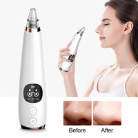 New electric blackhead removal and pore cleaning for blackheads