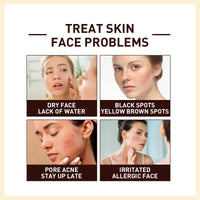 Rice Anti Wrinkle Essence, Repairs Skin Moisturizes Firms Whitens Essence