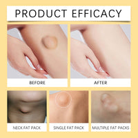 Bee Venom Fat Creme Moisturizes Skin Soothes Clumps Soothing Body Care Cream