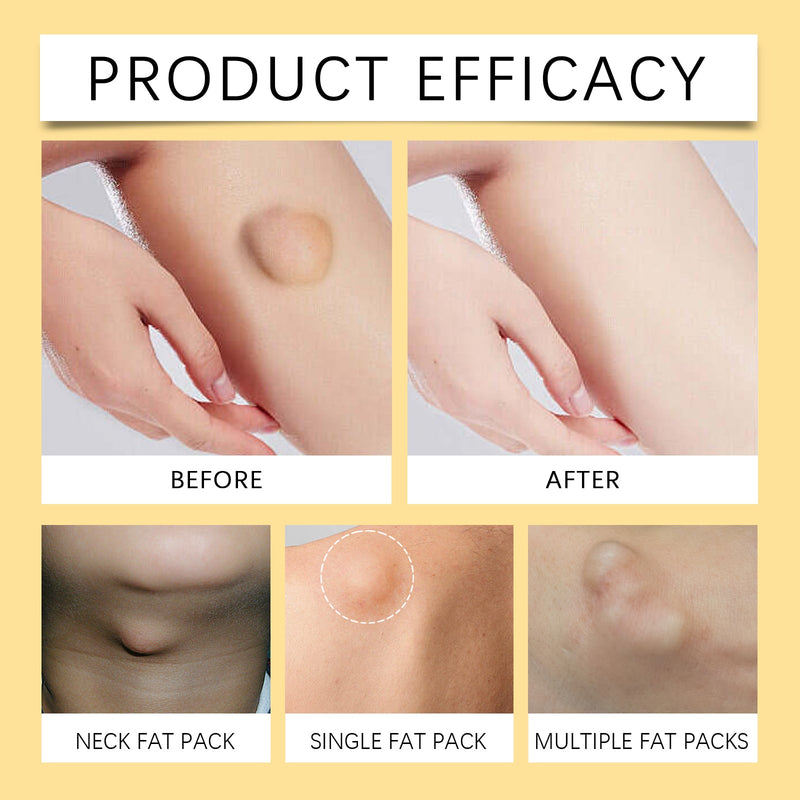 Bee Venom Fat Creme Moisturizes Skin Soothes Clumps Soothing Body Care Cream