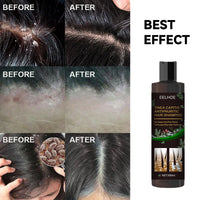 Tinea Capitis Anti-Itch Shampoo Anti-Drop Refreshing Oil Control Hair Care Anti-Dandruff Anti-Itch Shampoo