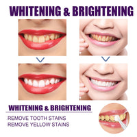 V34 Purple Dental Pen Oral Cleaning, Removing Stains And Brightening Teeth Oral Care Dental Pen