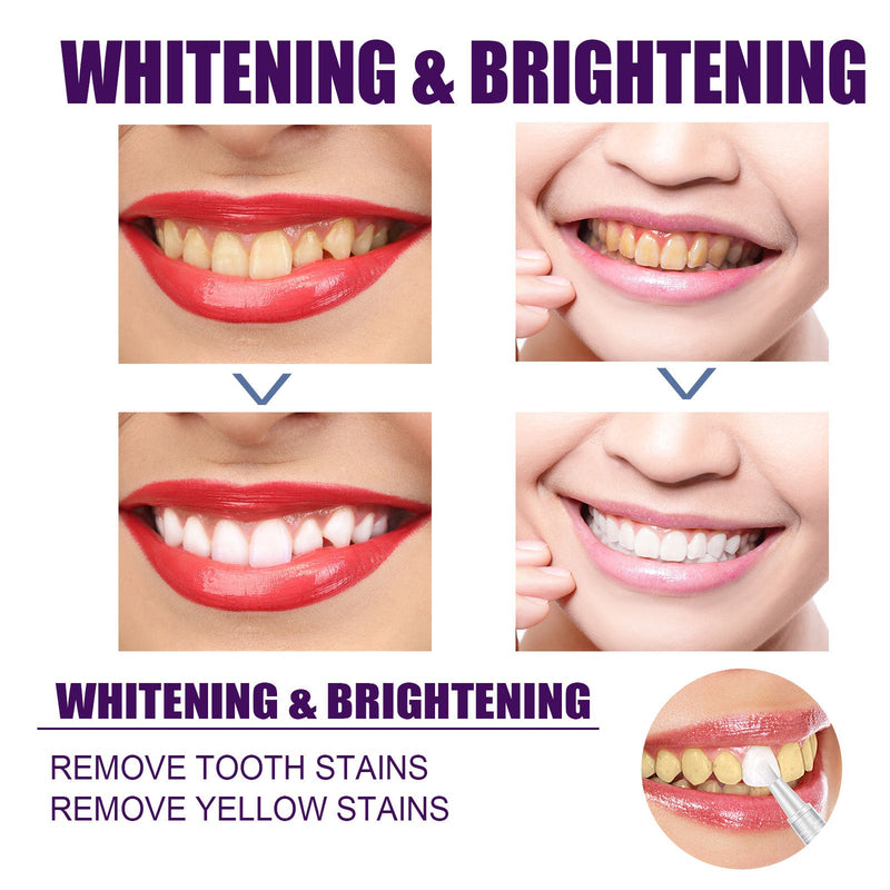 EELHOE V34 Purple Dental Pen Oral Cleaning, Removing Stains And Brightening Teeth Oral Care Dental Pen