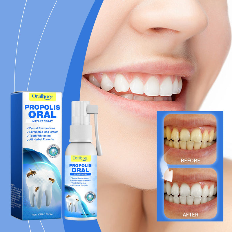 Propolis Oral Instant Spray, Clean Your Teeth To Protect The Gum Freshen Breath Oral Care Spray