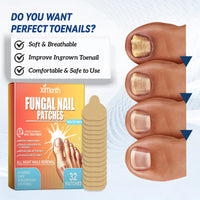 Fungal Nail Patches, Repair Thickening Gray Nail Rotten Nails Embedded Nails Soft Nails Bright Nails Toe Care