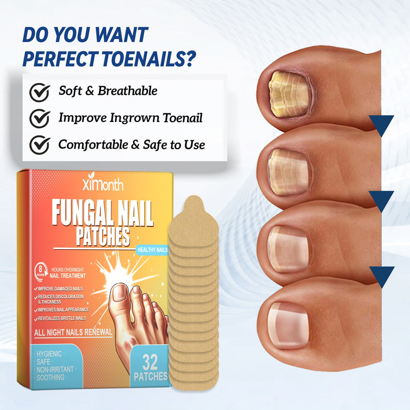 Fungal Nail Patches, Repair Thickening Gray Nail Rotten Nails Embedded Nails Soft Nails Bright Nails Toe Care