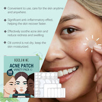 EELHOE Acne Patch Skin Care Set, Facial Daily Gentle Cleansing Care Soothing Nourishing Skin Care Patch