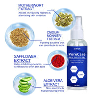 Porecare Skin Care Spray, Cleanser Warts Fade Moles Corns Smooth Skin Care Spray