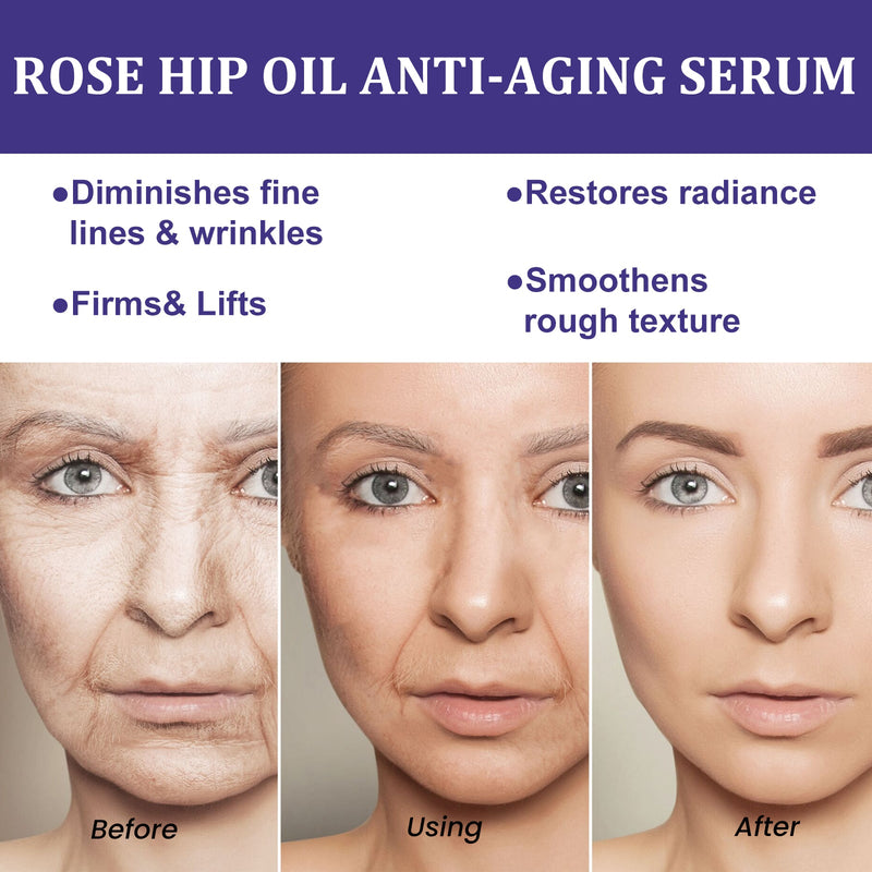 Rose Hip Oil Face Essence Brightening, Smoothing, Reducing Dullness, Smoothing Fine Lines And Firming Skin Essence