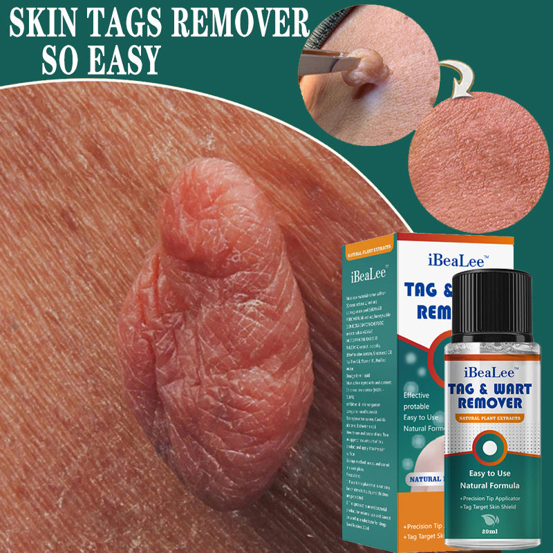 Flat and sharp warts, with a warm and moisturizing facial warts remover