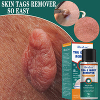 Flat and sharp warts, with a warm and moisturizing facial warts remover