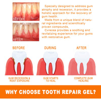 EELHOE Tooth Repair Essence, Cleaning Teeth Stains Tartar Care Gums Oral Care Essence