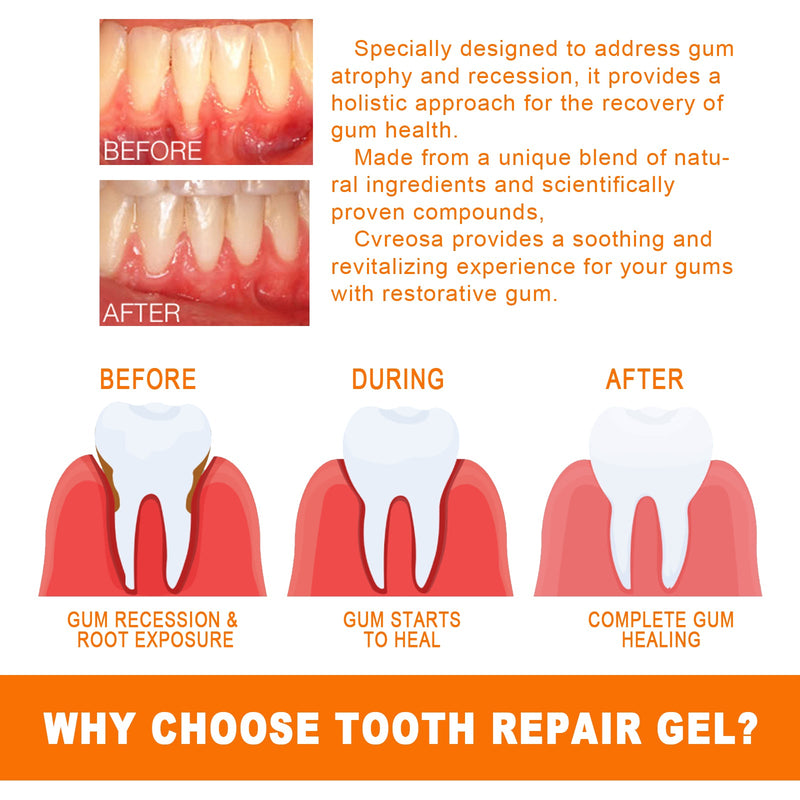 EELHOE Tooth Repair Essence, Cleaning Teeth Stains Tartar Care Gums Oral Care Essence