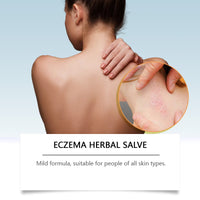 WoodSleep Herbal Cream Herbal Formula Relieves Skin Redness And Moisturizes Skin Externally
