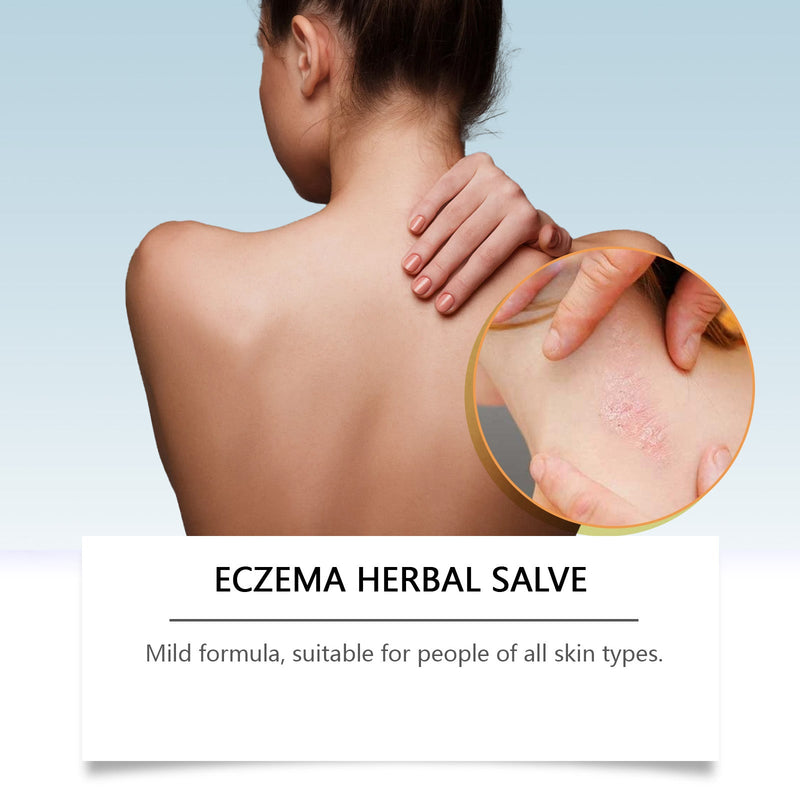 WoodSleep Herbal Cream Herbal Formula Relieves Skin Redness And Moisturizes Skin Externally