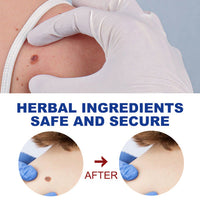 EELHOE Kayu Liquid Pen Gently Cleanses Skin Care Body Face Label Meat Pellet Kayu Liquid