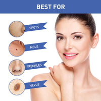 Warts Remover Cream, Body Skin Gram Wart Mole Meat Ball Wart Gentle Clean Smooth Skin
