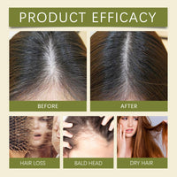 Herbal Hair Growth Oil, Prevent To Take Off The Thick Hair Essence Thick Hair Growth Liquid Dropping Essence Nourishing Repair Hair Relieve Dry Short-Tempered Hair Meek