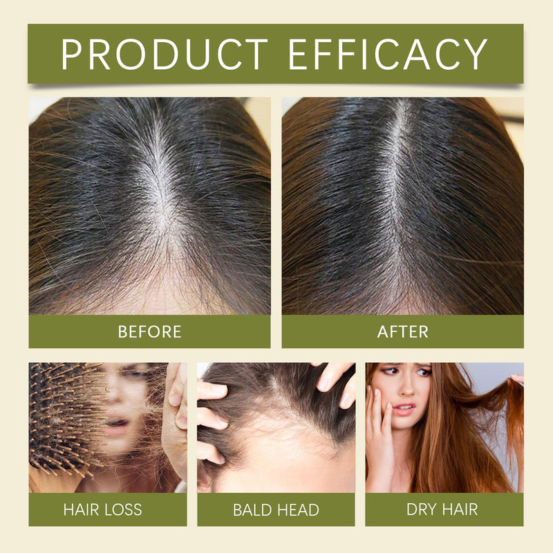 Herbal Hair Growth Oil, Prevent To Take Off The Thick Hair Essence Thick Hair Growth Liquid Dropping Essence Nourishing Repair Hair Relieve Dry Short-Tempered Hair Meek