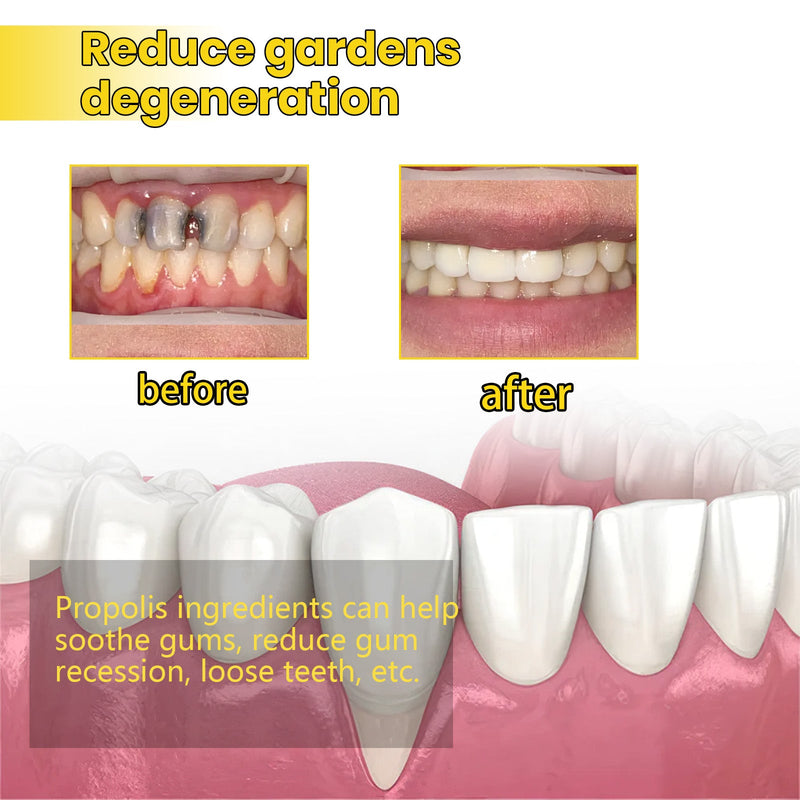 Propolis Gum Care Gel, Oral Care Clean And Repair Teeth Yellow Stains Whitening Teeth
