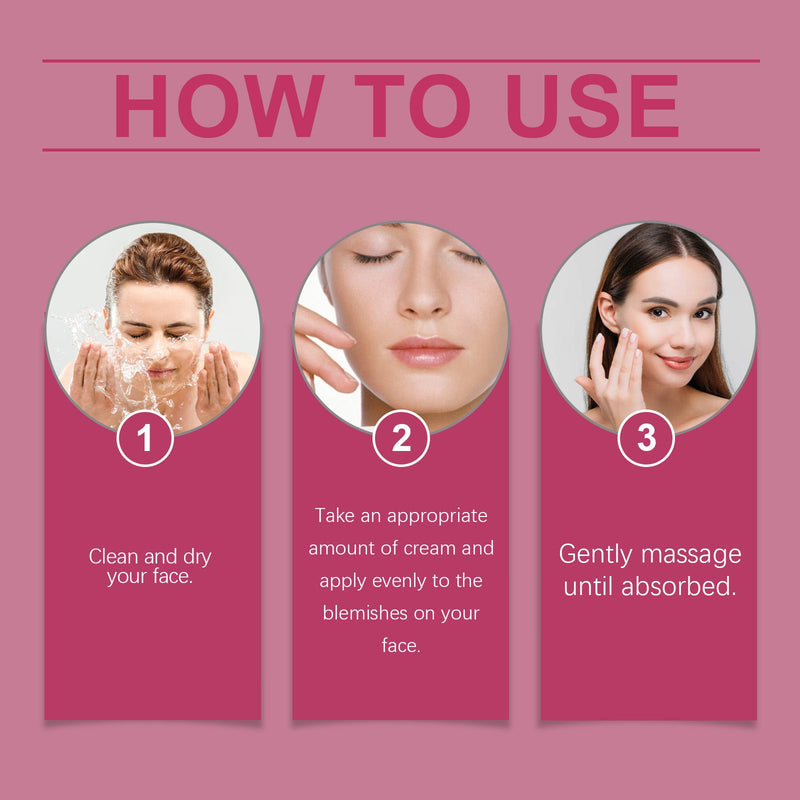 Melasma Spotless Concentrate, Moisturizing Firming Skin Refreshing And Dark Spots Skin Creams