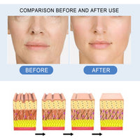 Face Ampoule Essence Lightening Facial Blemishes Cleaning Pores Refreshing Moisturizing And Tender Skin Essence