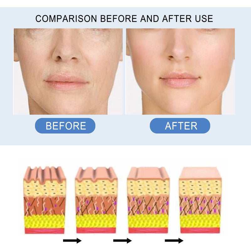 Face Ampoule Essence Lightening Facial Blemishes Cleaning Pores Refreshing Moisturizing And Tender Skin Essence