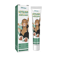 South Moon Vitiligo Relief Cream, Repair White Spots Flower Spots Skin Topical Care Ointment