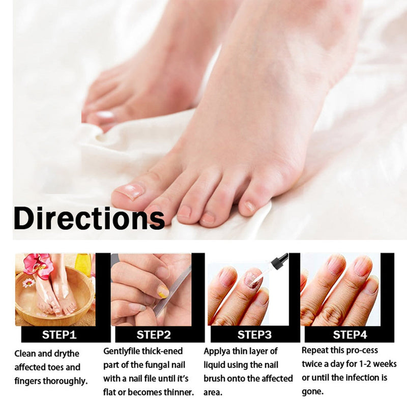 EELHOE Nail Repair Solution Thickening Brightening Nails Removing Gray Nails Dead Skin Repair Nourishing Nail Care Solution