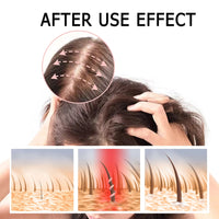 East Moon Boost Hair Serum, Prevent Hair Loss Strengthen Thicken And Nourish Hair Roots Hair Care Serum Set