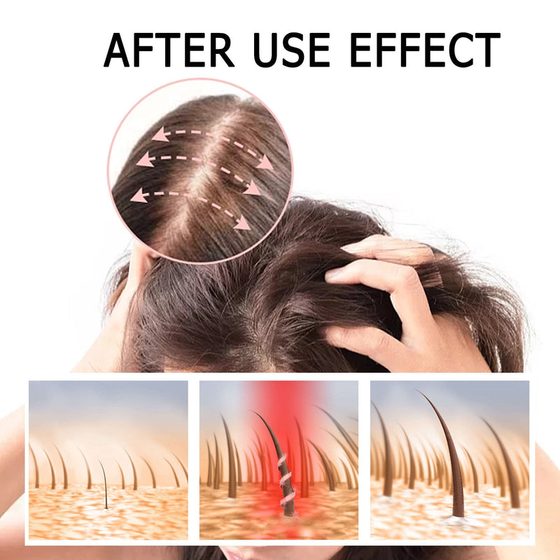 East Moon Boost Hair Serum, Prevent Hair Loss Strengthen Thicken And Nourish Hair Roots Hair Care Serum Set