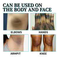 Acanthosis Nigricans Therapy Lotion, Armpit Joint Knee Fade Melanin Deep Nourishing Whitening Skin Tender Skin