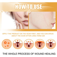 EELHOE Desalting Skin Scar Cream, Skin Burn Scalding Surgical Scar Wound Repair Cream