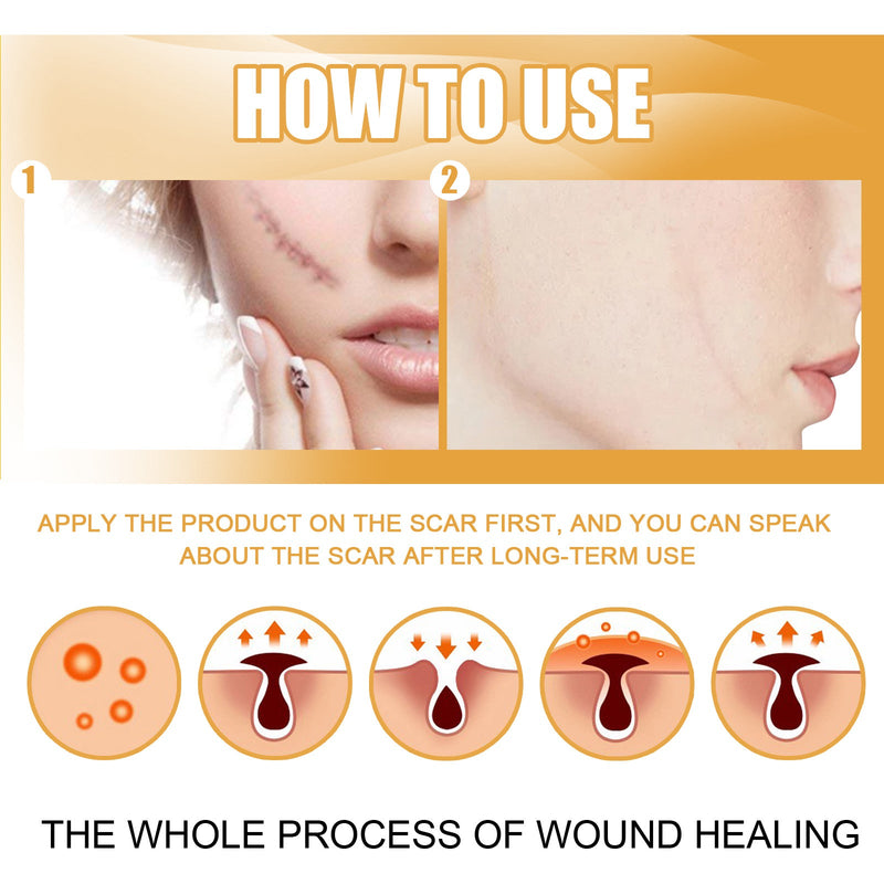 EELHOE Desalting Skin Scar Cream, Skin Burn Scalding Surgical Scar Wound Repair Cream