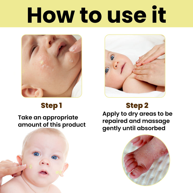 Baby Anti-Crack Cream Anti-Crack Cream, Foot Body Moisturizer Skin Cream Hand And Foot Hydrating Moisturizer