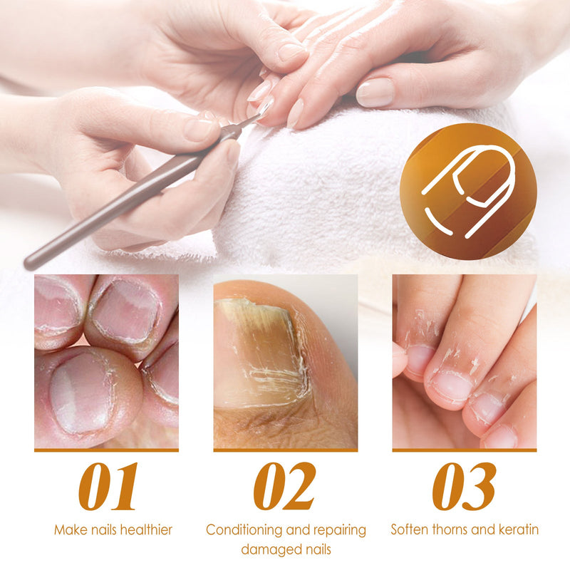 Instant Cuticle Treatment Gel Repair Gray Nails Soft Nails Rotten Nails Dead Skin Moisturizing Treatment