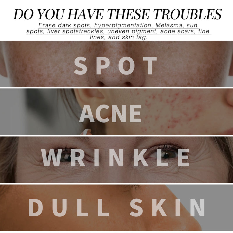 Retinol Essence, Firming Fine Lines And Lightening Melasma Moisturizing Anti-Wrinkle Essence