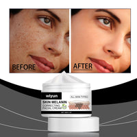 Wiyun Moisturizing Face Cream, Skin Care Moisturizing And Moisturizing To Enhance Skin Hydration Natural Gloss Facial Moisturizer
